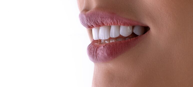 Get a Brighter Smile with Snow Teeth Whitening